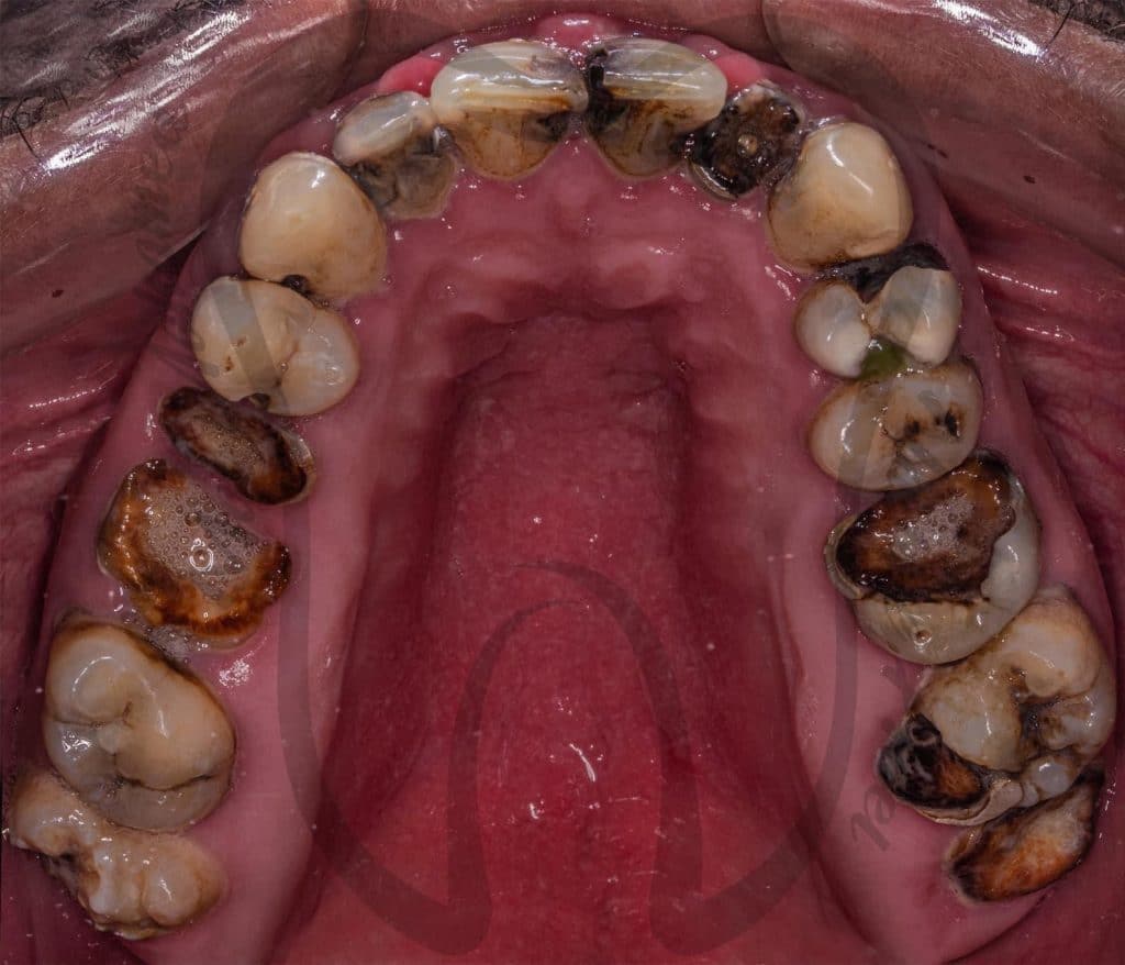 1EFF8717-3C9E-4BF4-B961-EFE7AFD18A92