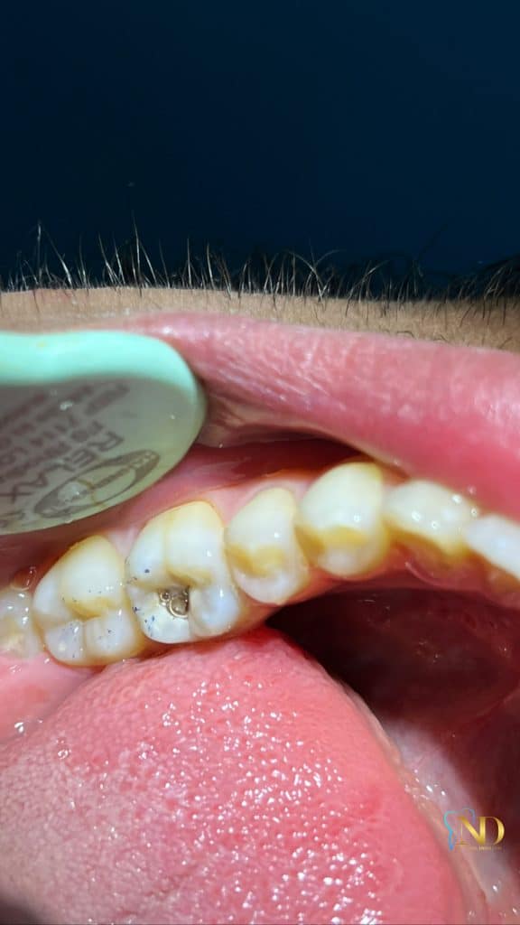 3B192A78-86A5-4F47-8B85-F633D6F8FB56