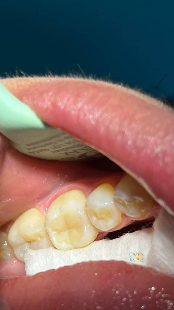 422C1A86-C71A-435D-B072-F55B3200251F