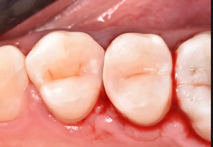 57A402F0-CA68-4BB9-84BC-360D7D4E59F2