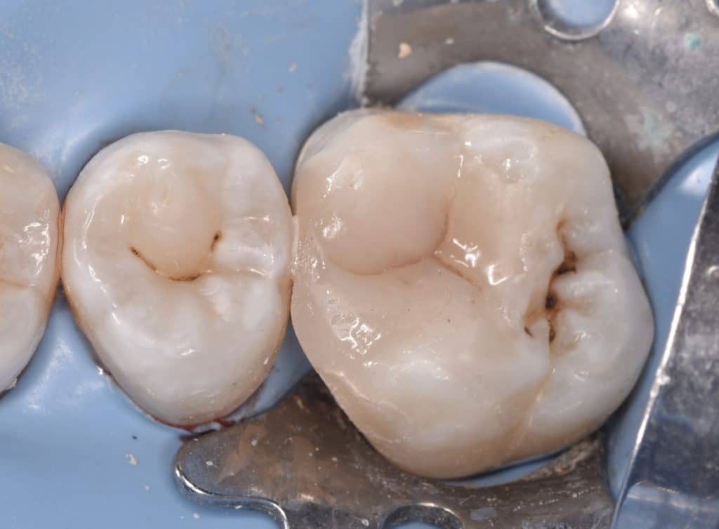 7A94CB8D-90F3-498D-91F3-9DFFBCBB7C29