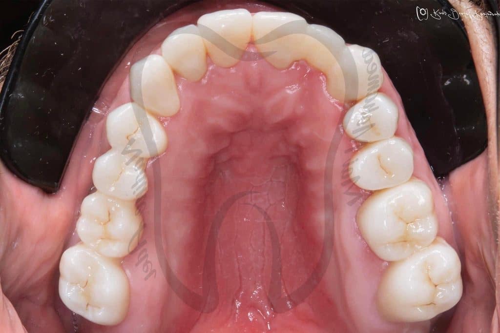 90AE0492-BA26-4D16-B121-96C4E014FC5A