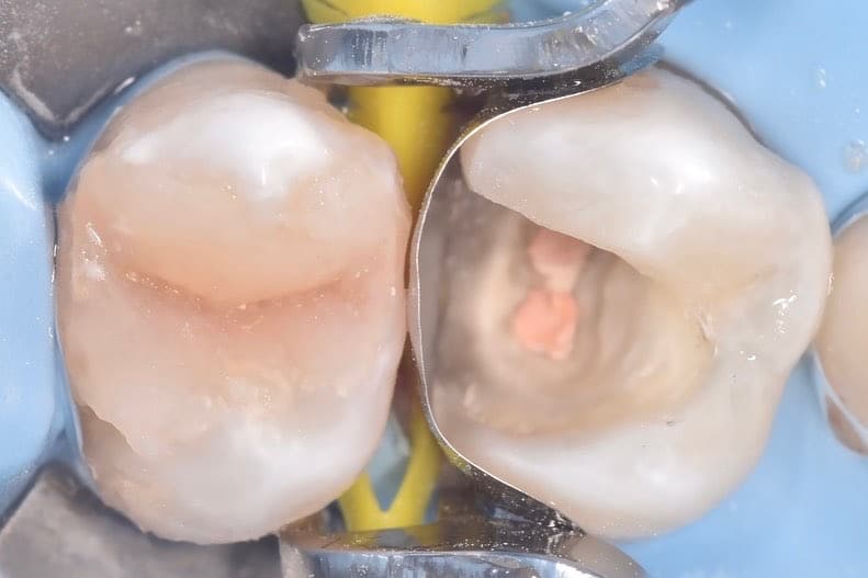 9A46C7A5-1676-4DC9-A1B1-0CDF862D138B