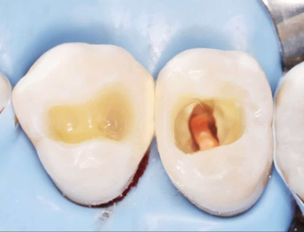 BAD33B88-5E27-4B60-93F1-6CEAC7D57647