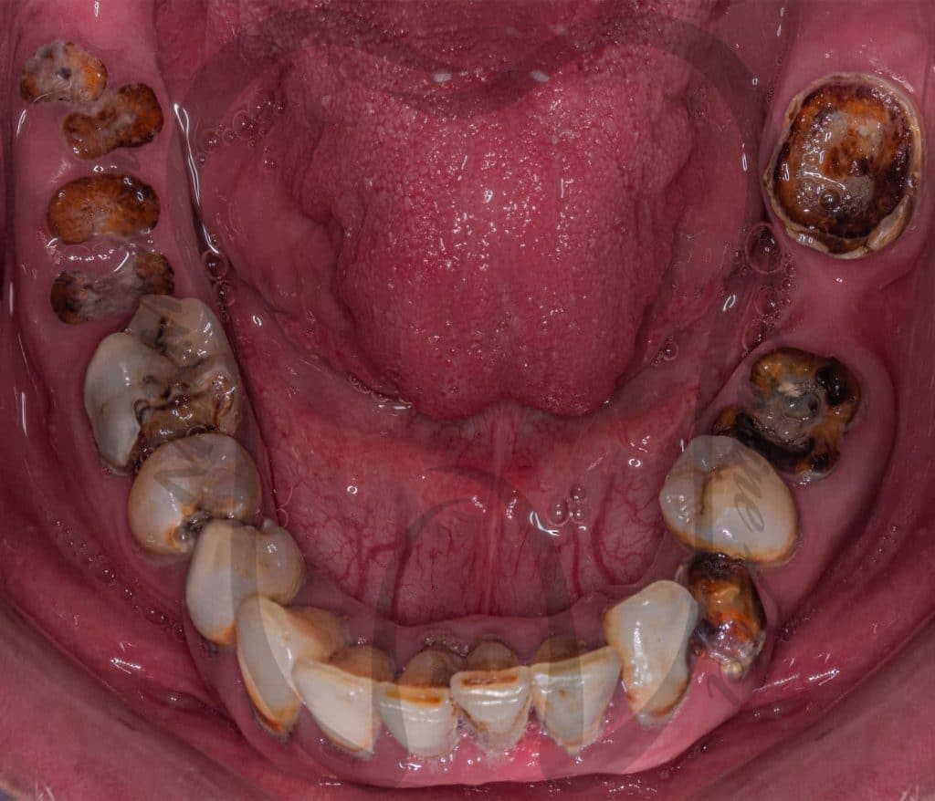 E4303713-29A3-49BA-A31B-569486581DF8