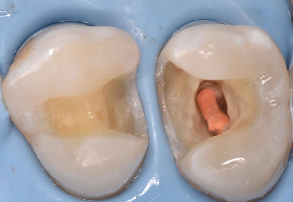 E5D34CD5-006E-4470-A0CD-CB92F853147F