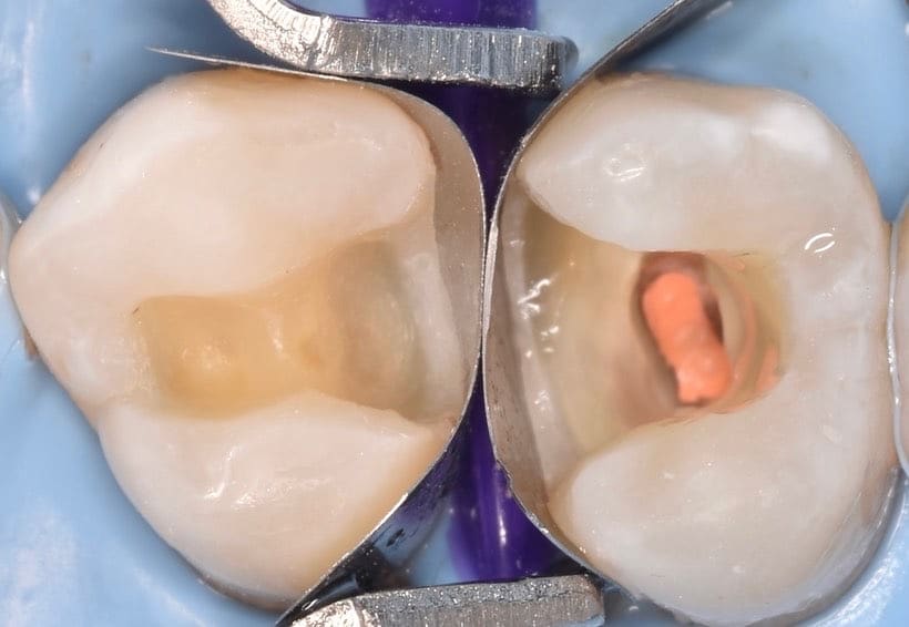 E6490C42-FB7E-48E4-959C-2FDD71BE93C6