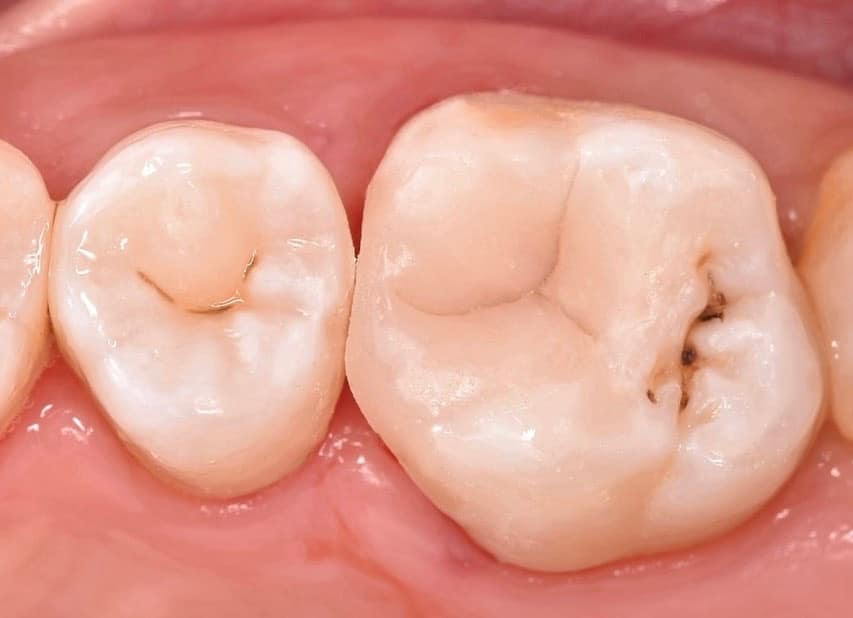 E92F4F9A-833A-4FAA-A074-15173FCABC58