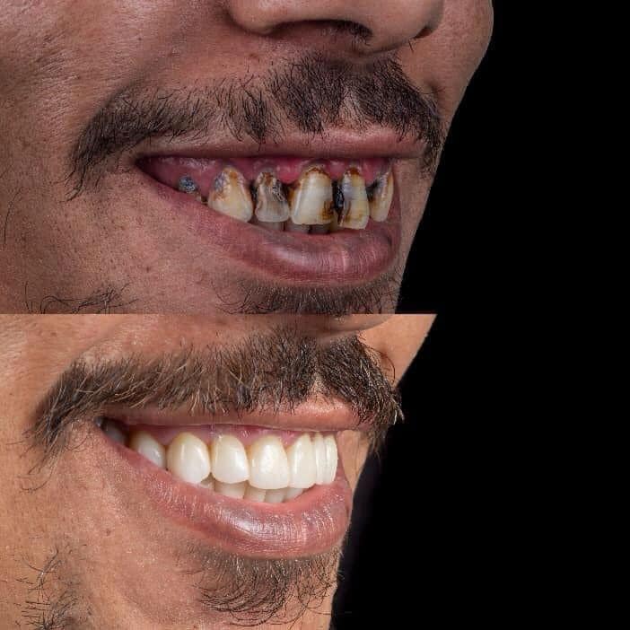 F71A6D91-2C88-406B-B131-8E3A90EA3EF9