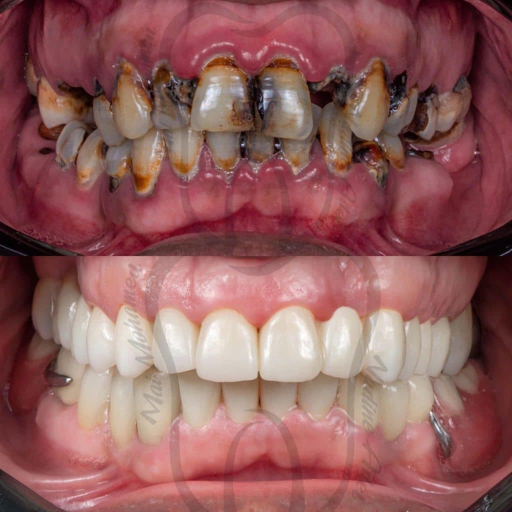 F9D13FB2-D435-4DF6-97CE-055E38E26FE0