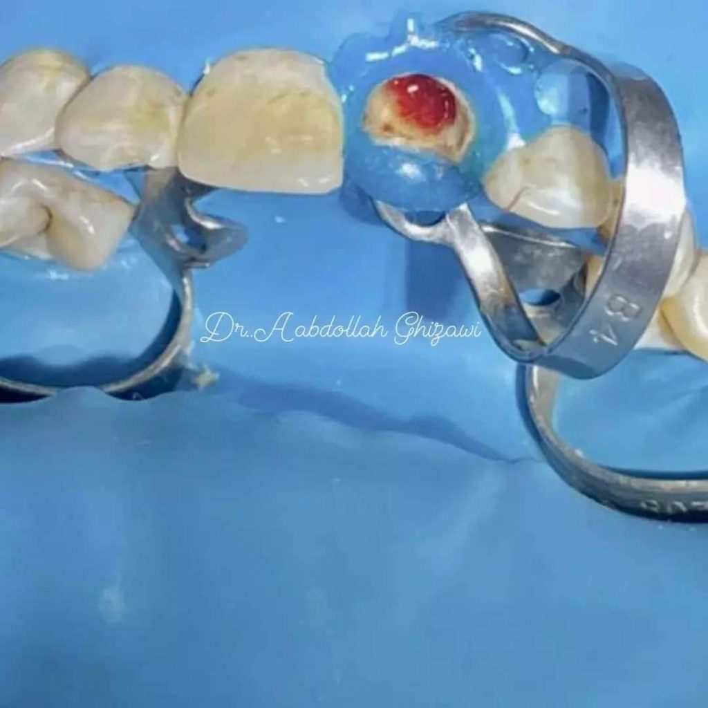 FB_IMG_1653921612632