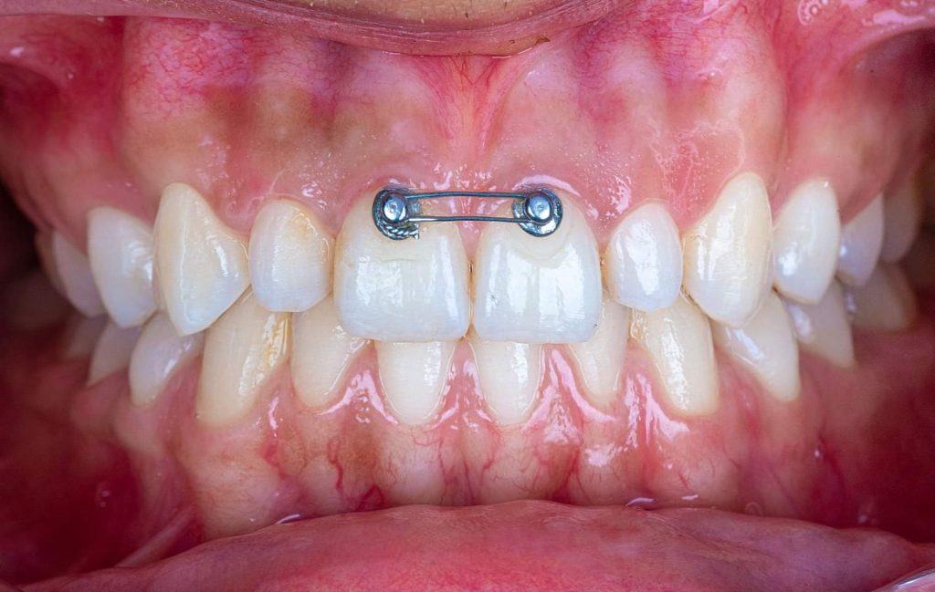 FB_IMG_1654076478351