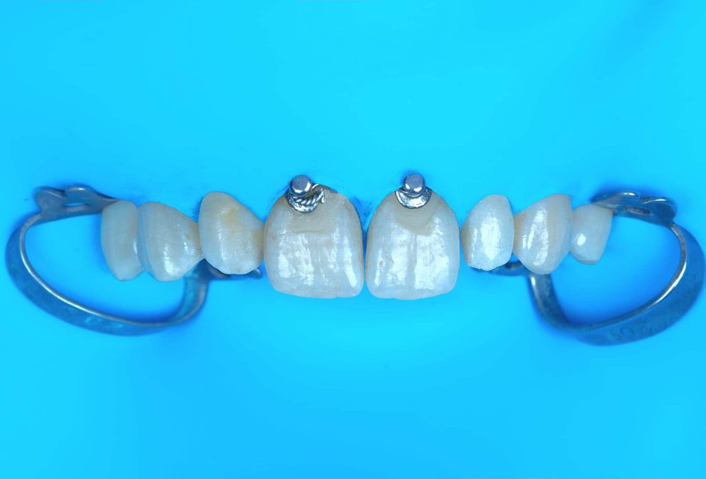 FB_IMG_1654076489764