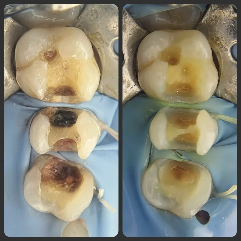 IMG_20220607_212548_860