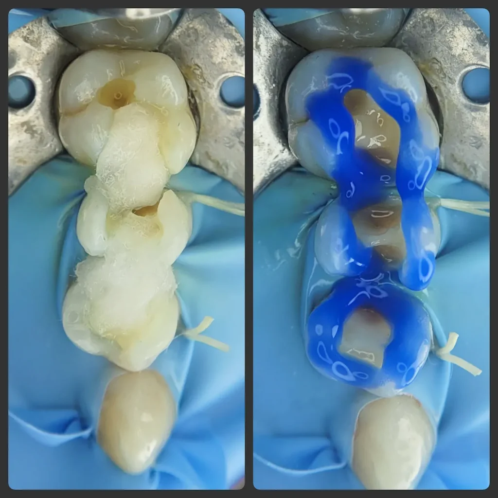 IMG_20220607_212549_089