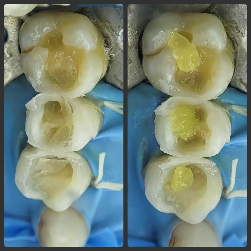 IMG_20220607_212549_151