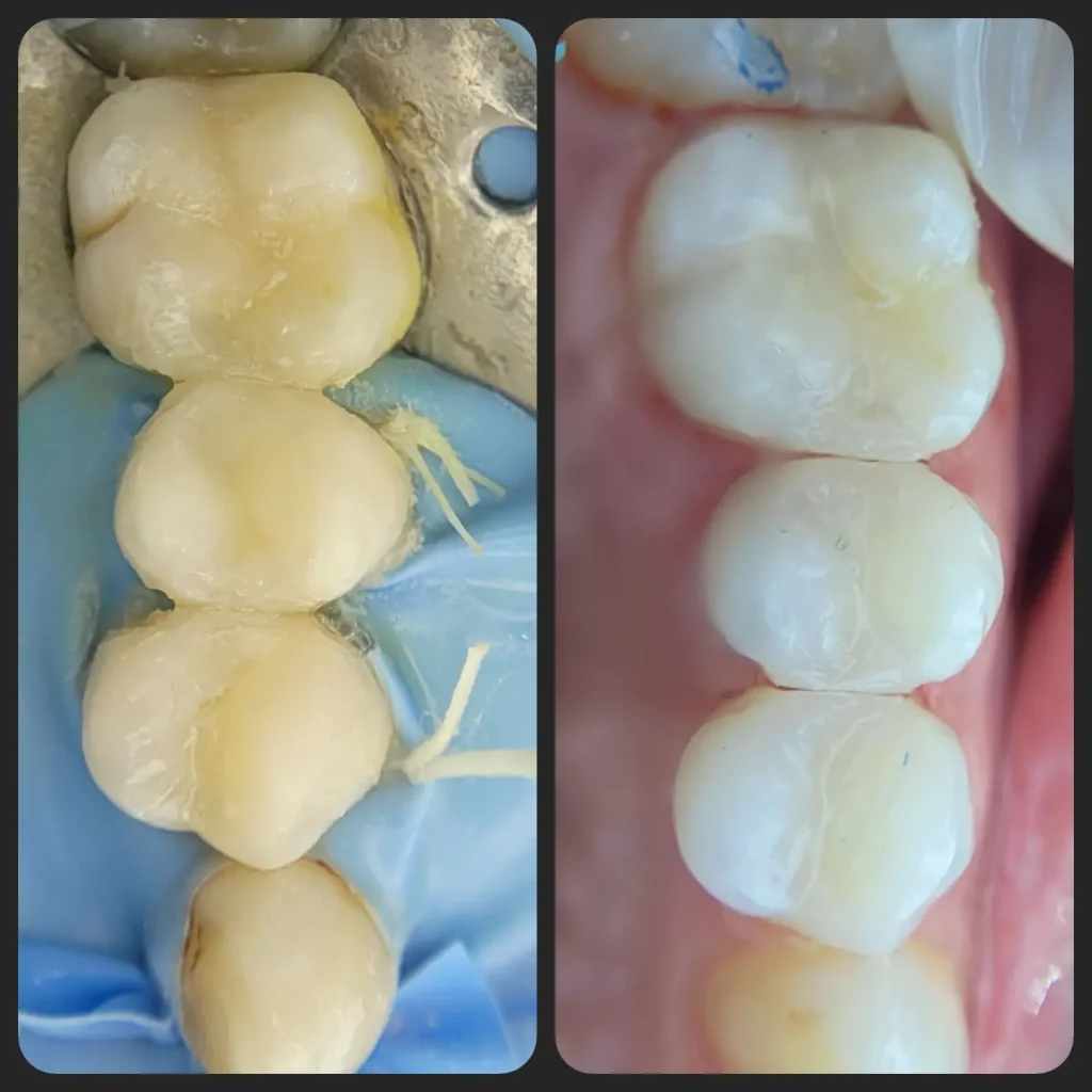 IMG_20220607_212549_168