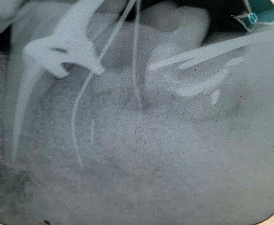 inbound1050797586517947180