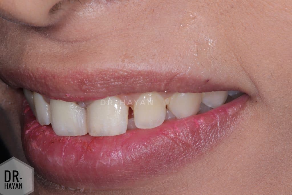 08A19813-78D0-497D-8DAE-24A856A7E48A