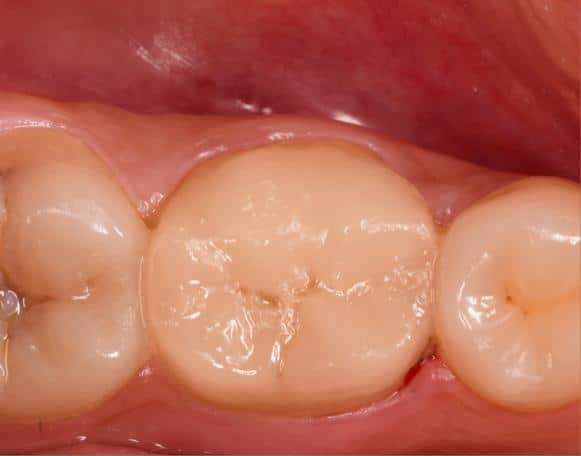 327946856_902081554299558_6524543173332693069_n