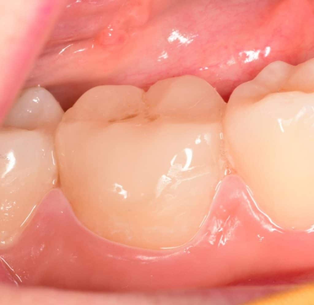 328967682_843510733612459_5311207806137112977_n