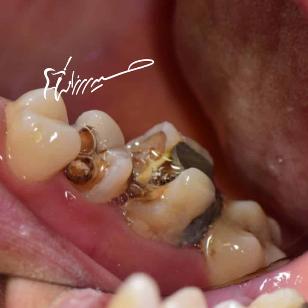 44450691-DE40-40DA-975B-919226091E45