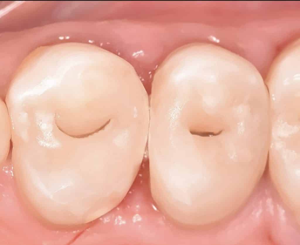 4E1BCBDB-A646-4C28-8B1C-16DD75041643