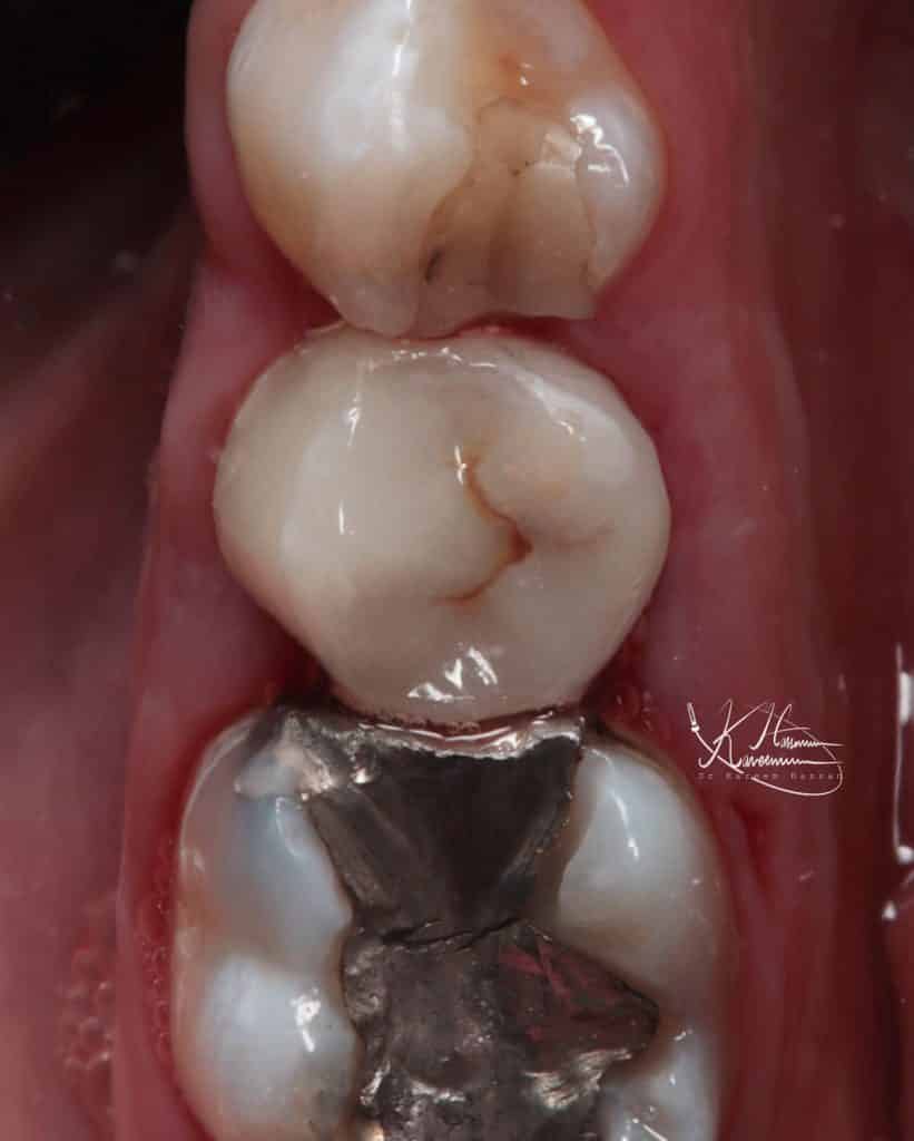 54A58FA6-A186-4A90-ACA4-DA5F4C27646D