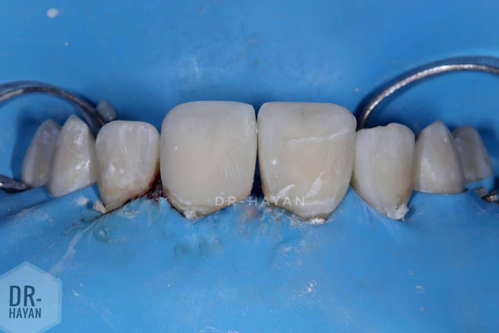 5BF1EE69-6711-4BD8-A392-A224F8EACEBA