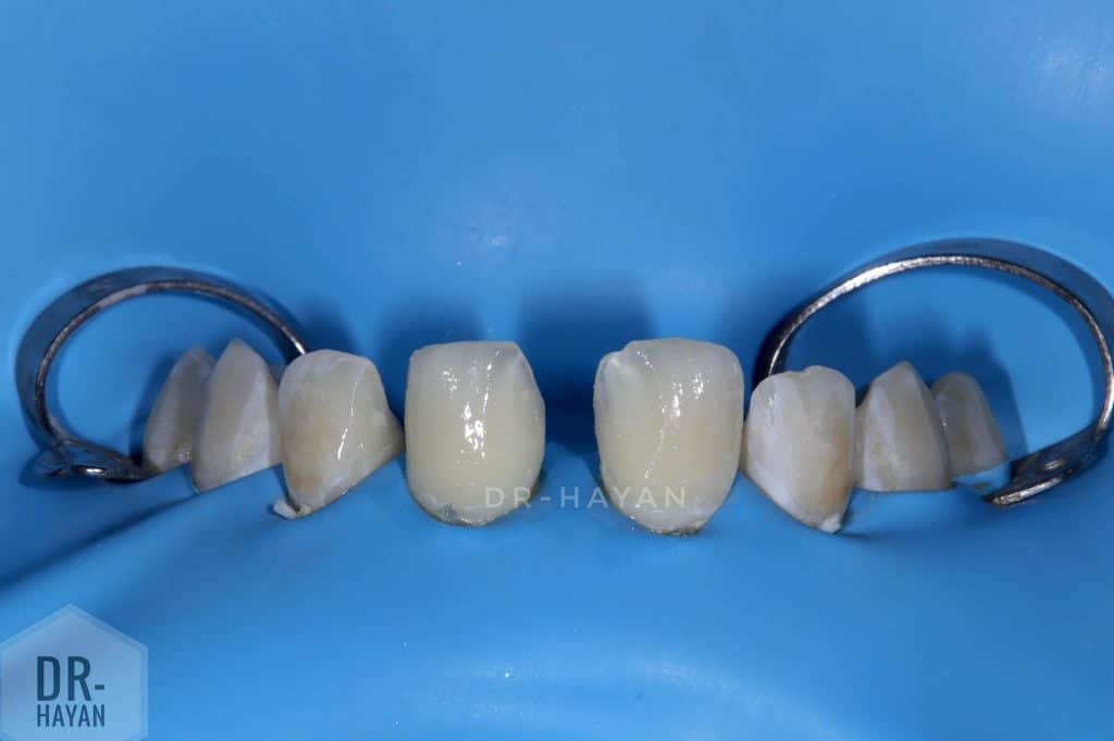 6FFA6925-81B5-4AA5-9D64-CF3A732D5A65