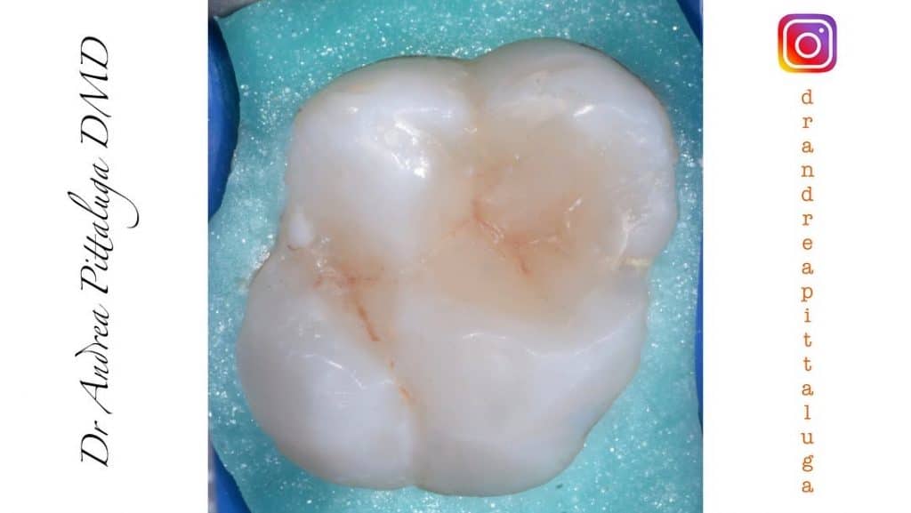 717E5054-A45B-4948-BF11-FDEA3AB4F8E1