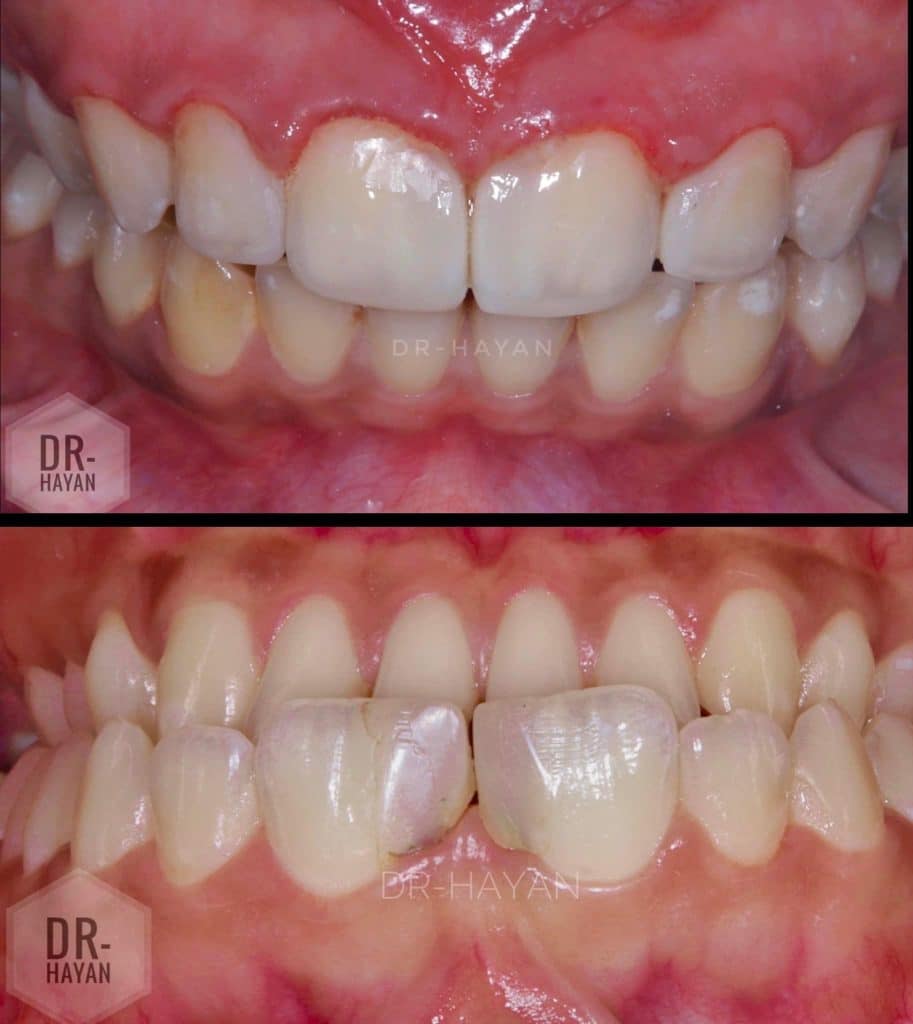 824F3EF9-182A-4A65-86A4-67DCC6B43F89