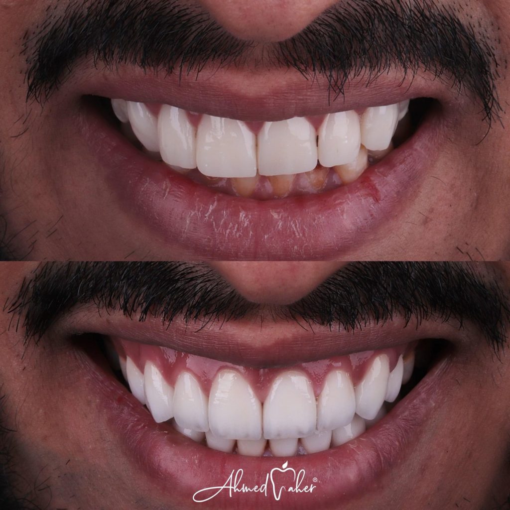 86EA6E6E-9E89-4D43-A866-C78F677AE023