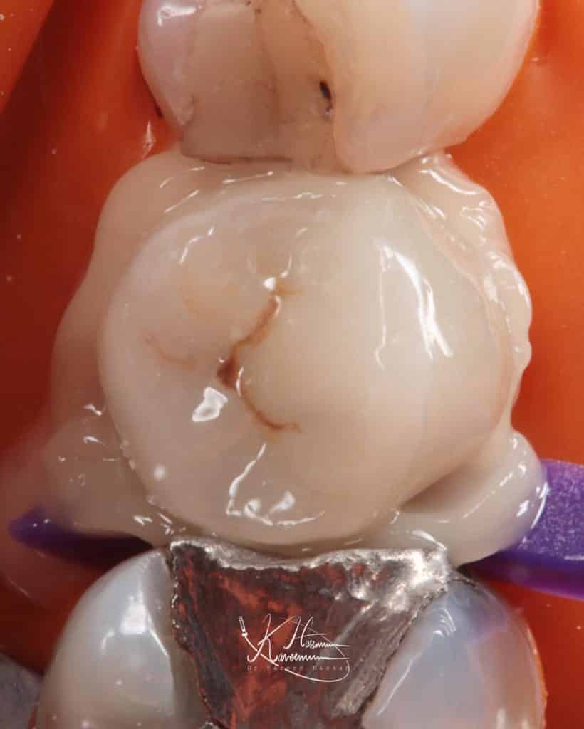 90B01F4D-664D-4CC2-B107-387835E385A2