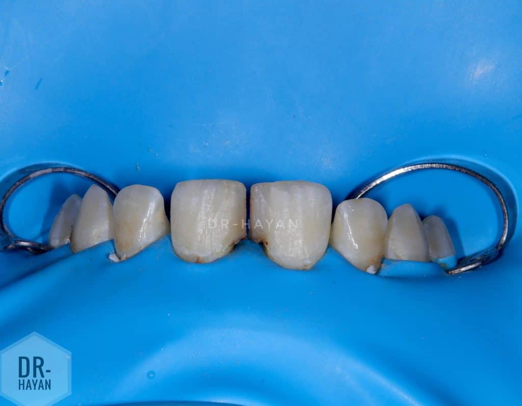 93B78959-B87C-4652-954A-DED689DEE3BA