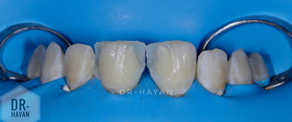 9F1EA424-E7C8-41FF-A885-7DBEA38126B9