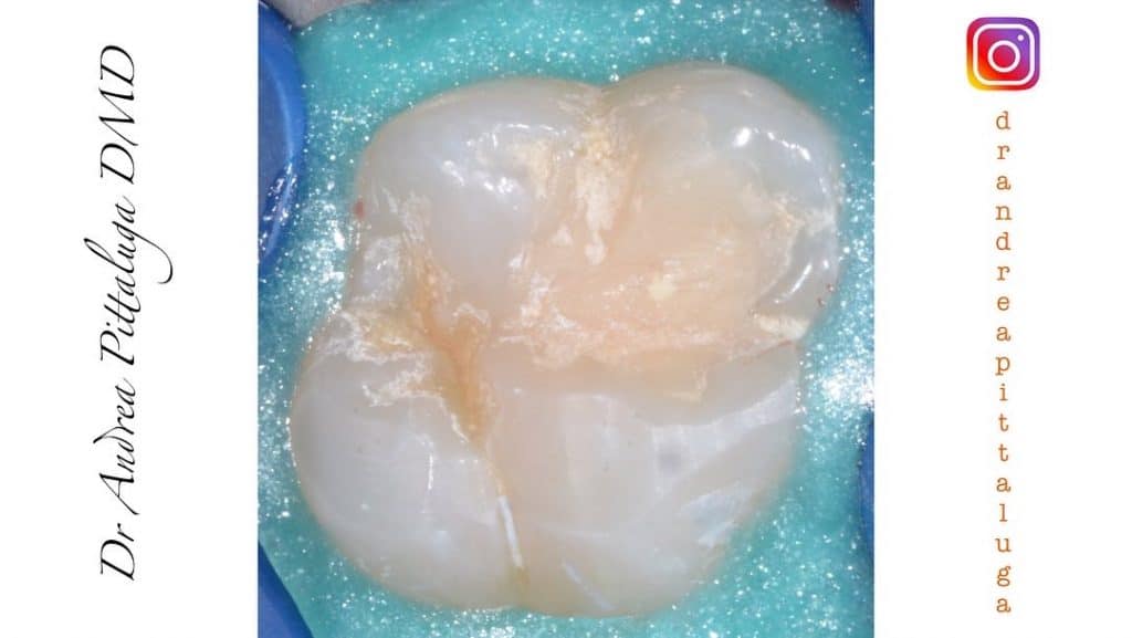 AD6F814E-1B25-474A-9818-6E35F036F061