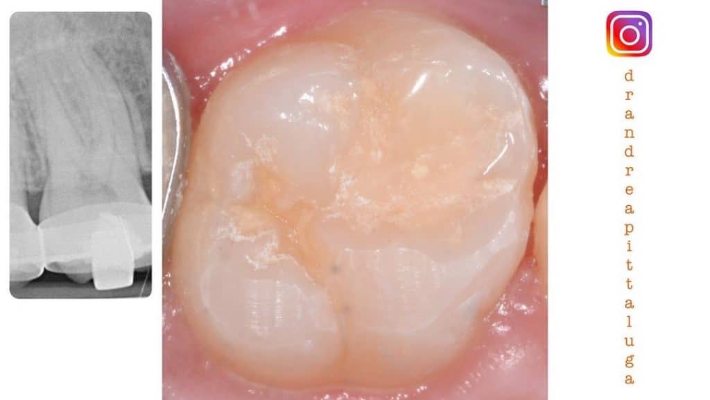 B007220A-E01F-48ED-B603-43721ABE119E