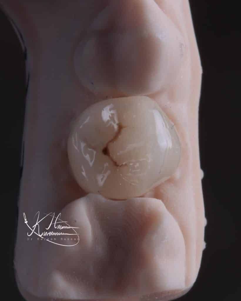 B1E9972A-E56F-4691-A9C4-379F912443E5