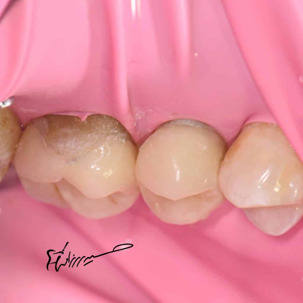 BCE7D07B-1C5D-4C2F-9991-5CAA75141AC6