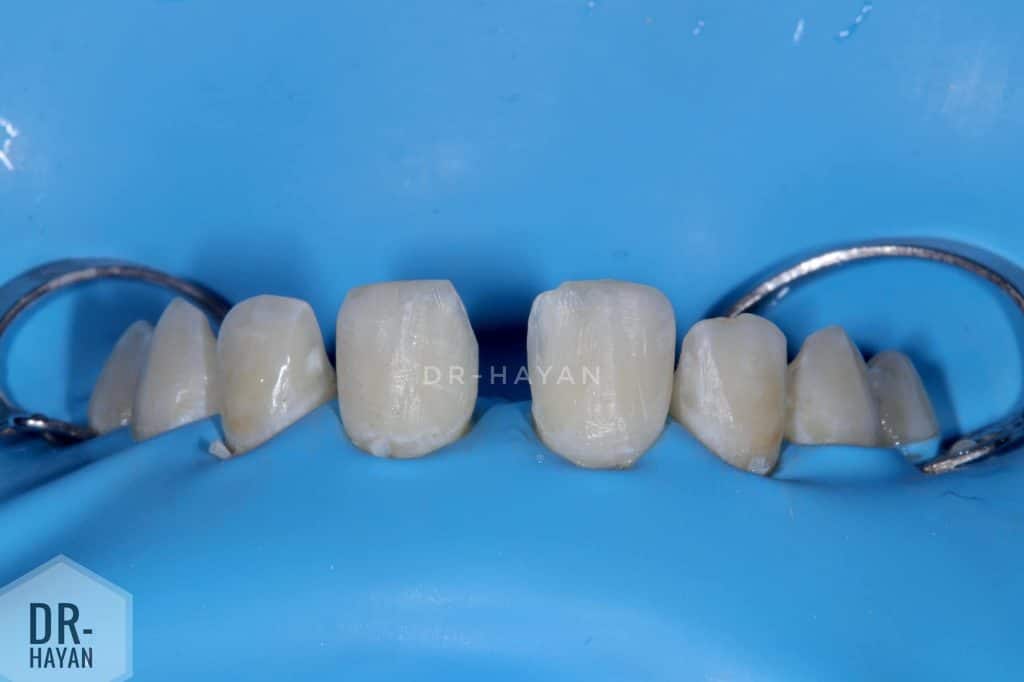 BF78B2DF-0FB1-4597-B225-8B1D7CD447A3