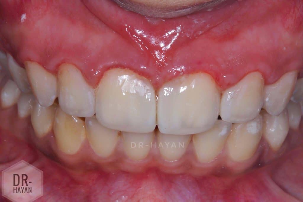 D66FD4B8-F754-4623-8162-DA336F4F8C95