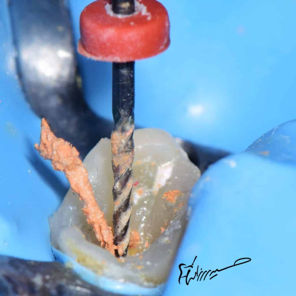 D9D1E5A7-276F-434E-AC1B-5FB5CFBD2C23