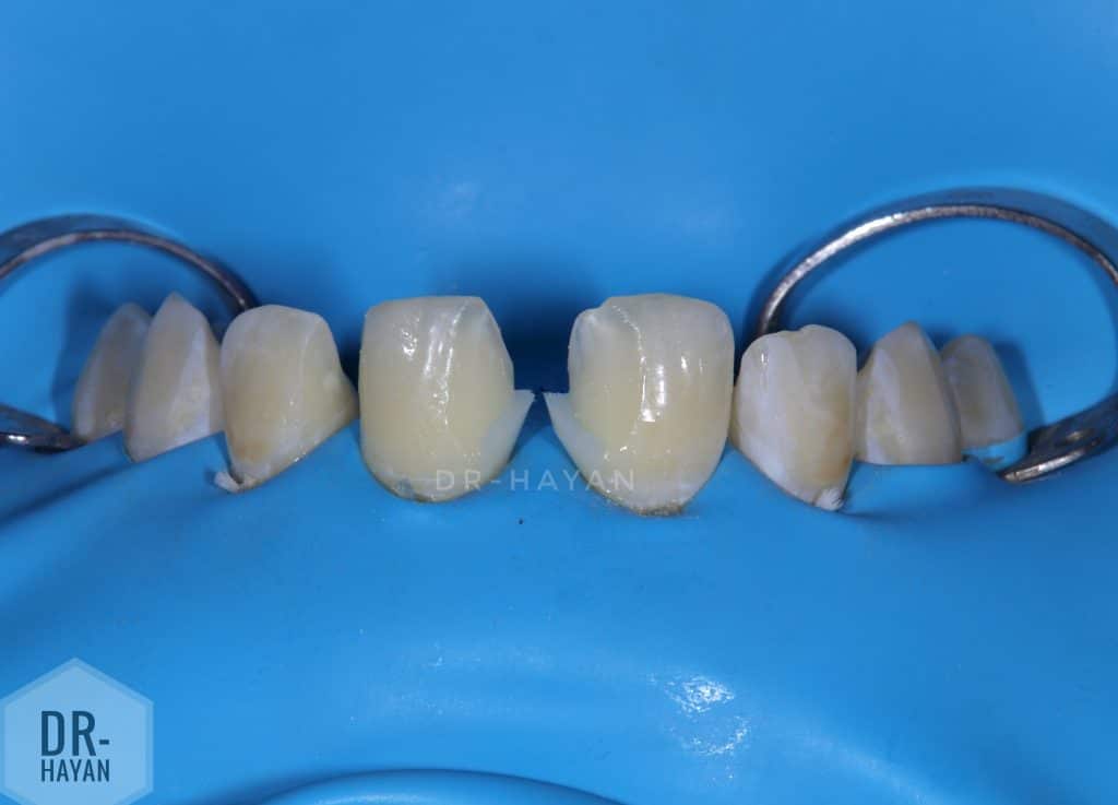 DF5F11EB-2C88-48BA-961F-A36C65932BCE