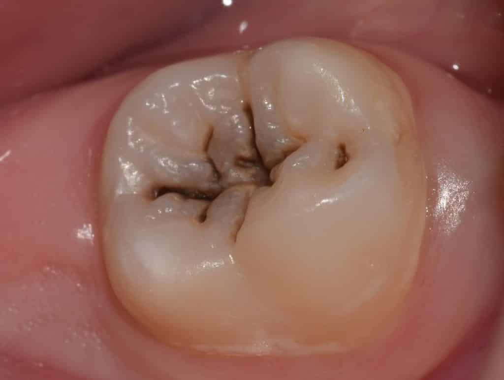 Fig. 01 : Initial situation