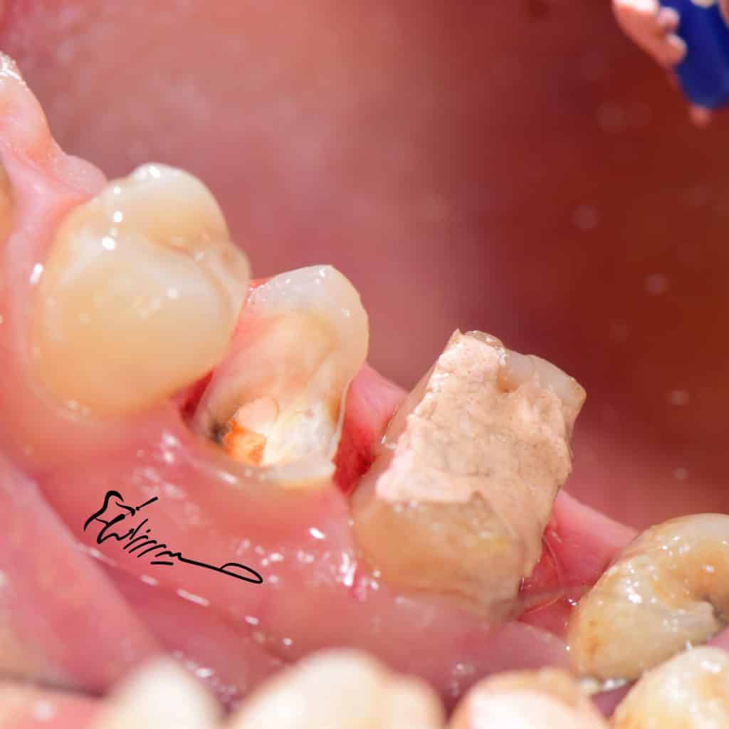 E2A30E0F-55C4-4C5E-BEC2-A0D99379D6A2