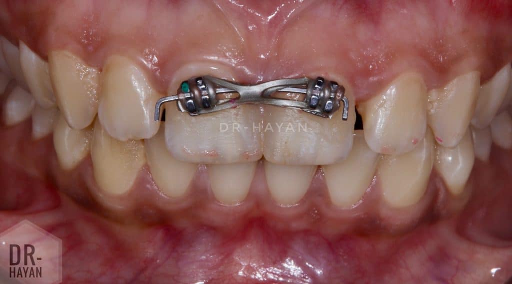 E8299DA8-69C4-4A1A-952F-6E047D3FC8AF