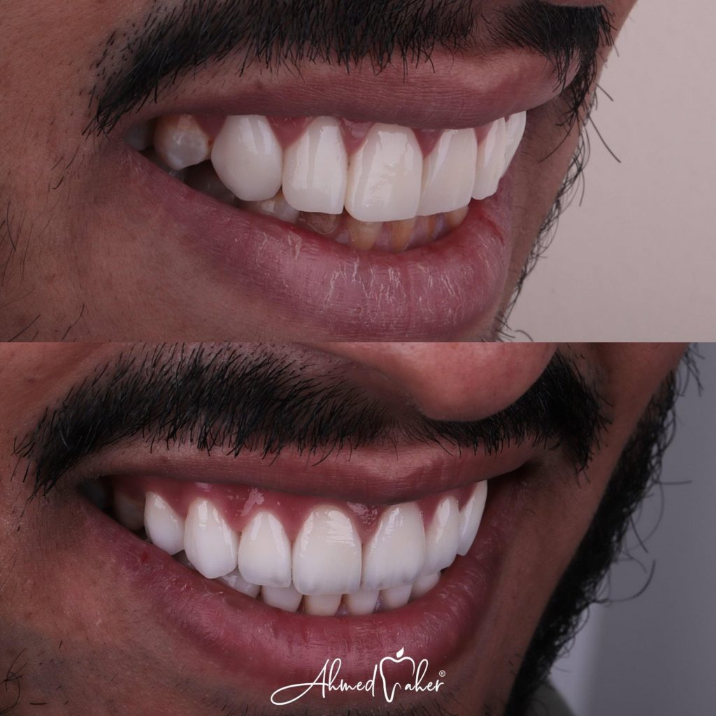 F6F5BFB2-CBCF-45EB-B7FB-AA4D6FD62A7B