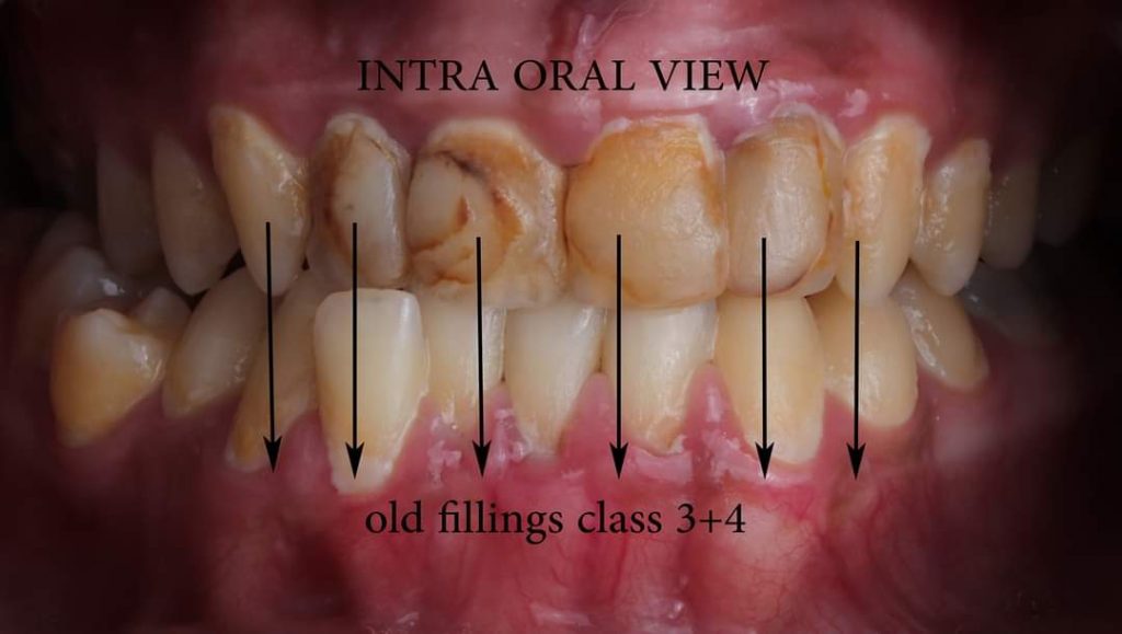 FB_IMG_1657135140811