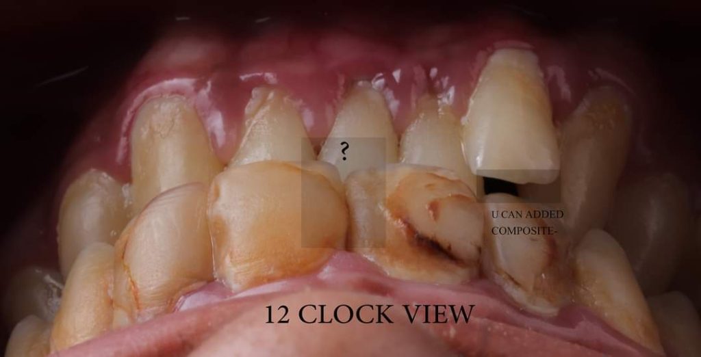 FB_IMG_1657135143765